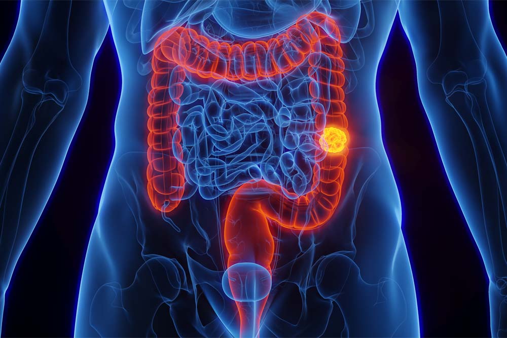 大腸のイメージ画像