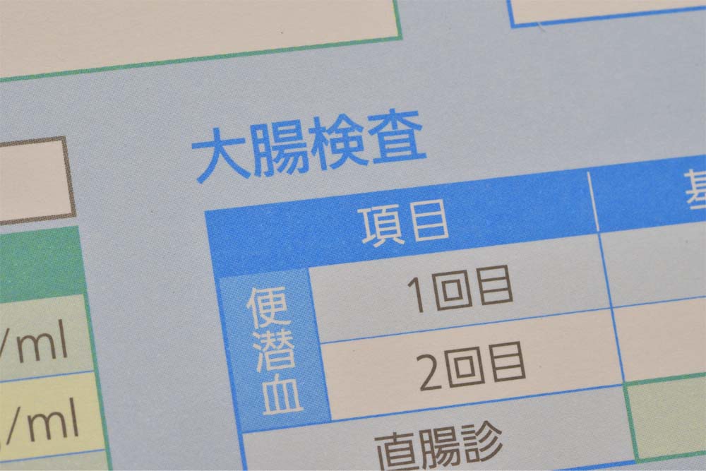 大腸のイメージ画像