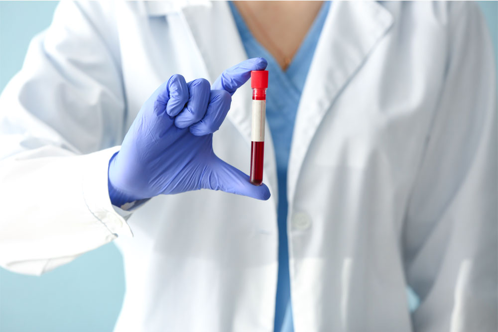 コレステロールを含めた血液検査の検体