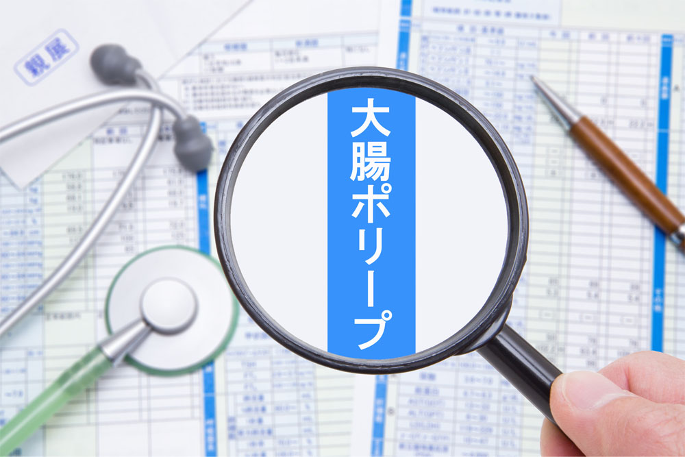 大腸検査結果用紙の大腸ポリープ部分を拡大しているところ